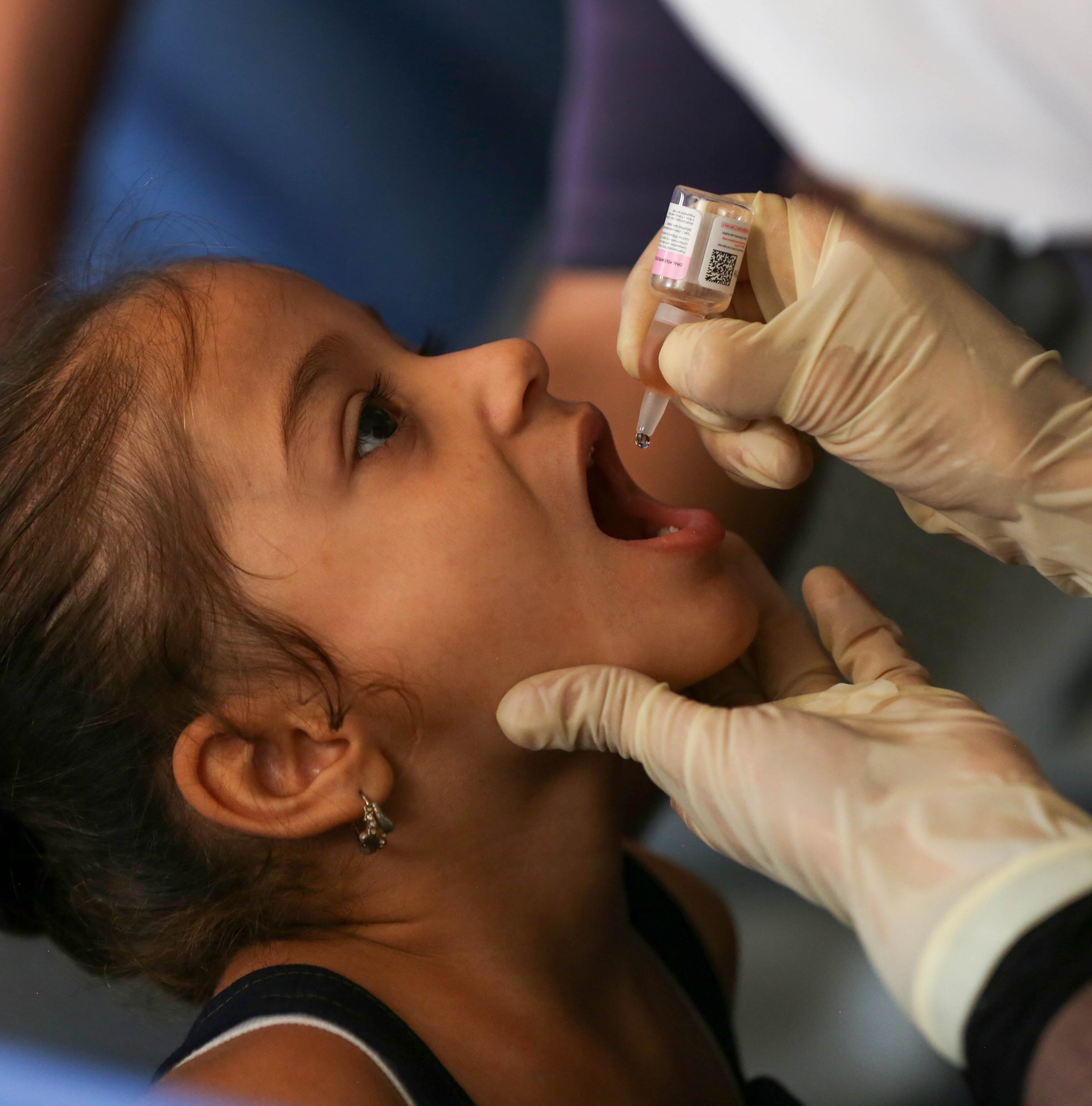 How a disease the world (mostly) vanquished reared its head in Gaza